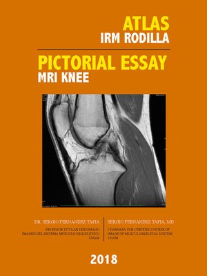 cover image of Atlas IRM Rodilla / Pictorial Essay MRI Knee